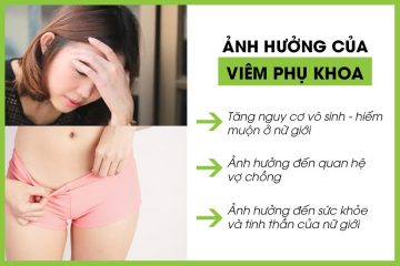 Hướng dẫn lựa chọn sản phẩm vệ sinh vùng kín để không tái phát viêm phụ khoa
