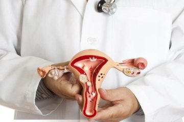 Teo âm đạo, những điều cần biết về hội chứng này