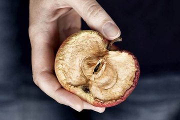 Khô âm đạo: Bạn có nguy cơ cao gặp phải tình trạng này không?