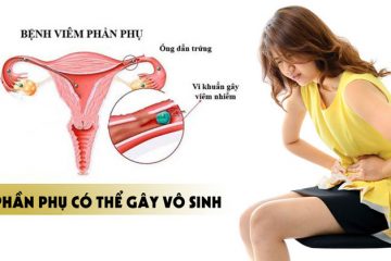 Nguyên nhân nào dẫn đến viêm phần phụ ở nữ giới?